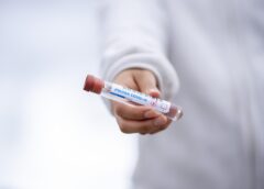 Next CoV variant on the rise – 2 symptoms dominate